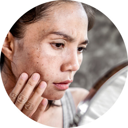 Dark spot correcting routine