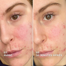 REN - EverCalm Redness Relief Serum for sensitive skin