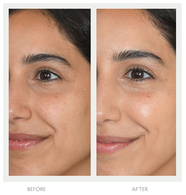 Tata Harper - Resurfacing Mask - Instant solution for dull skin