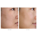 Tata Harper - Resurfacing serum - Daily dose of glow