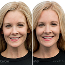 RMS Beauty - "Un" Cover-up #11.5 organic foundation & concealer