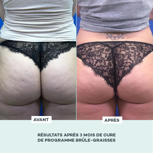 D-Lab - Fat Burner Program 