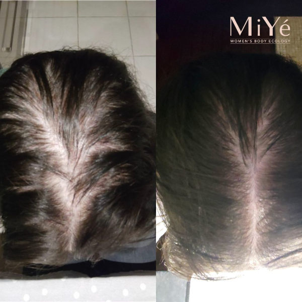 Miyé - Densifying & Anti Hair Loss serum Miyé - Densifying & Anti Hair Loss serum