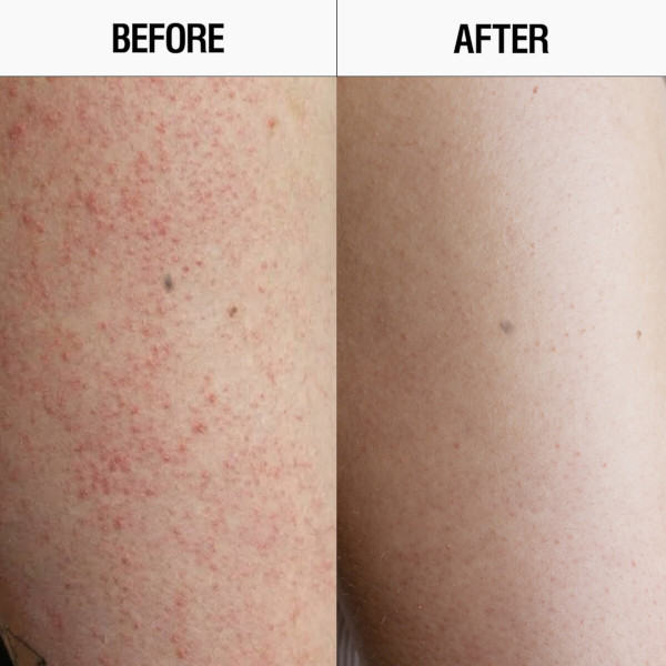 Grown Alchemist - Resurfacing Targeted Body Cleanser