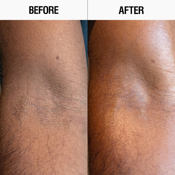 Grown Alchemist - Resurfacing Targeted Body Lotion