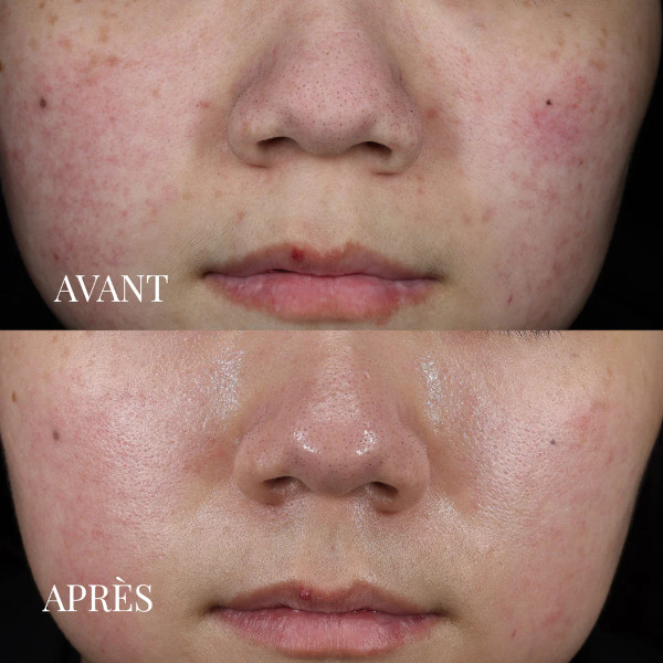 JOD - Detoxifying Skincare Mask