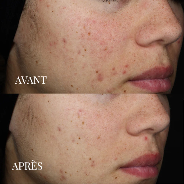 JOD - Detoxifying Skincare Mask
